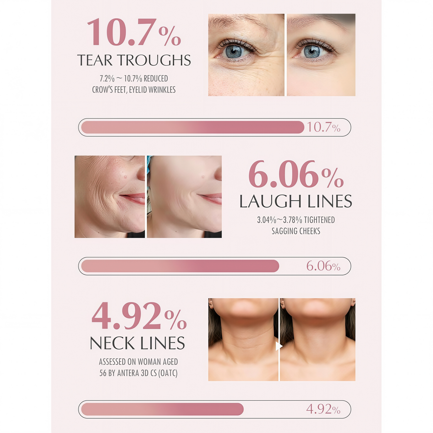 KAHI Wrinkle Bounce Multi Balm Stick | PDRN Collagen Wrinkle Stick | Korean Skin Care |All-in-One Hydrating Lip Balm Eye Cream Neck Cream Make Up Base & Face Mist Moisture Balm
